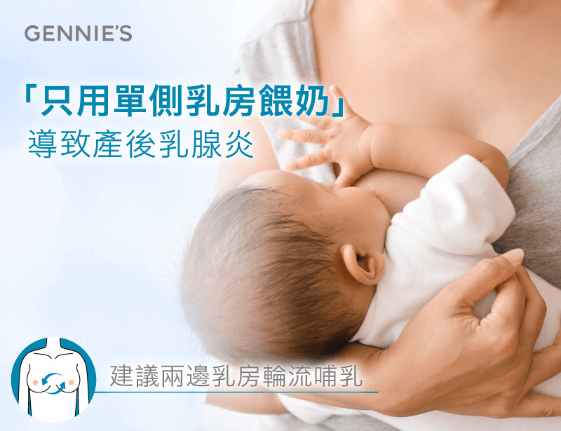 單側乳房哺乳-哺乳期乳腺炎