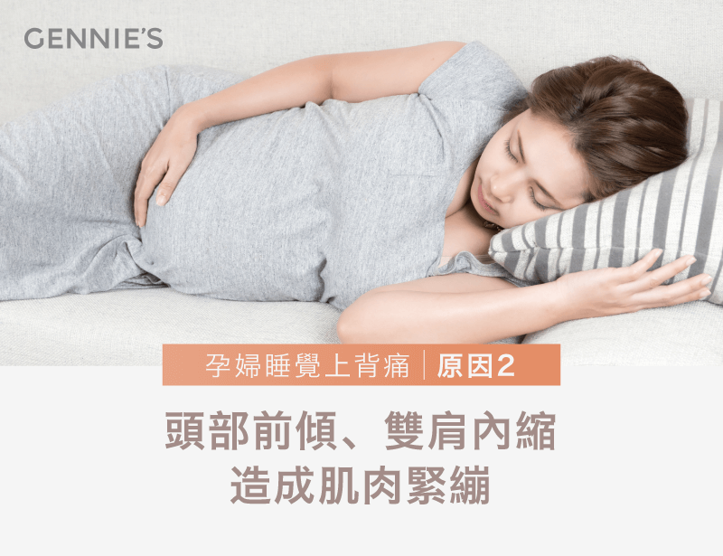 頭部前傾-孕婦睡覺上背痛