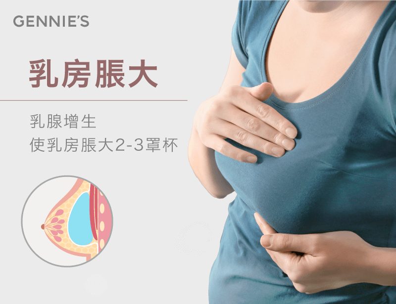 懷孕乳房脹大-懷孕後胸部會變大嗎