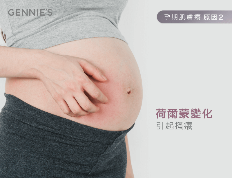 孕期荷爾蒙變化-懷孕皮膚癢