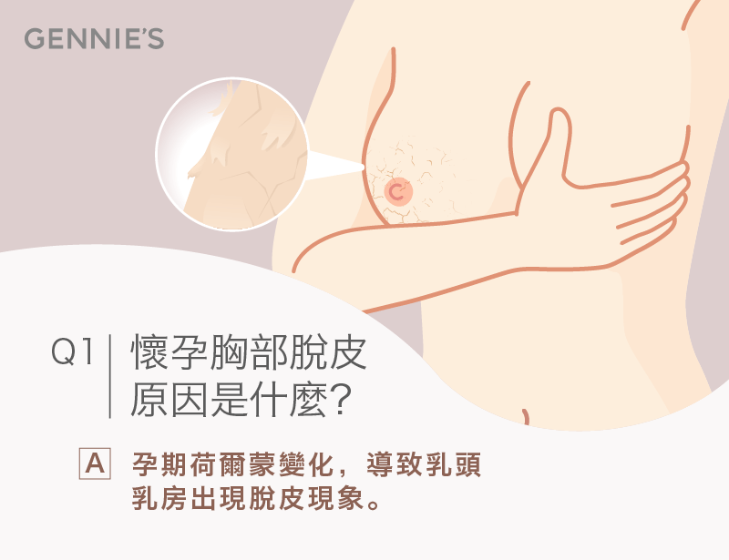 孕婦胸部脫皮原因-孕婦 胸部脫皮