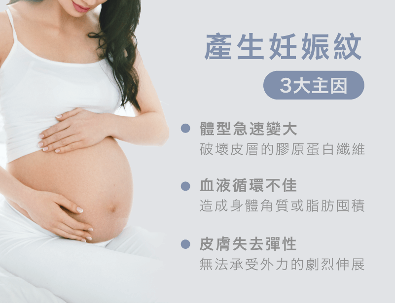 產生妊娠紋的3個主因-淡化妊娠紋