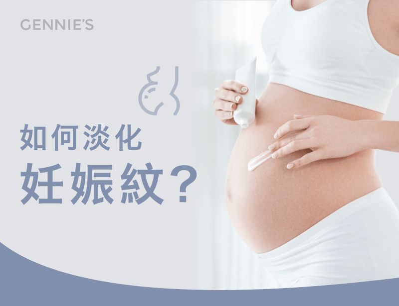 4方法了解如何淡化妊娠紋-如何淡化妊娠紋