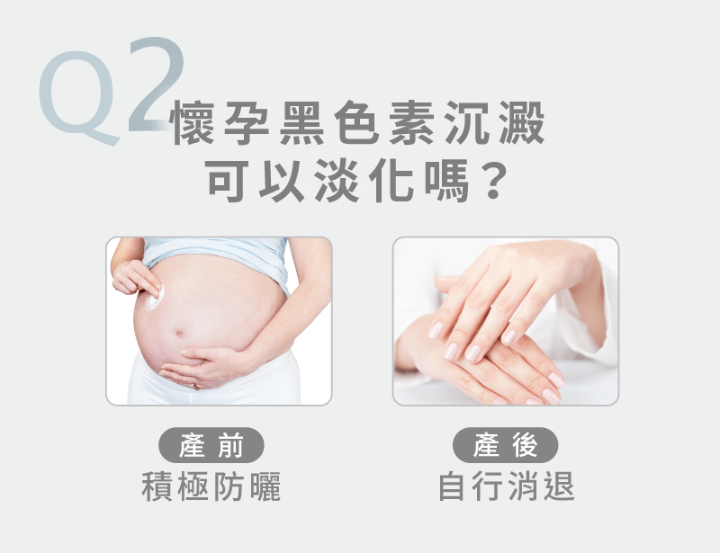 孕婦保養推薦-懷孕皮膚暗沉