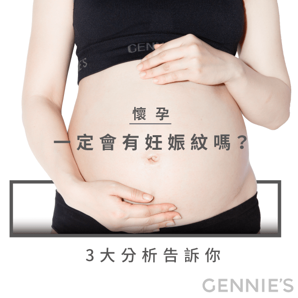 懷孕 妊娠紋-孕婦 妊娠紋