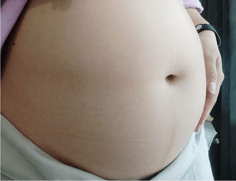 肚皮保養完畢後-孕期保養品推薦